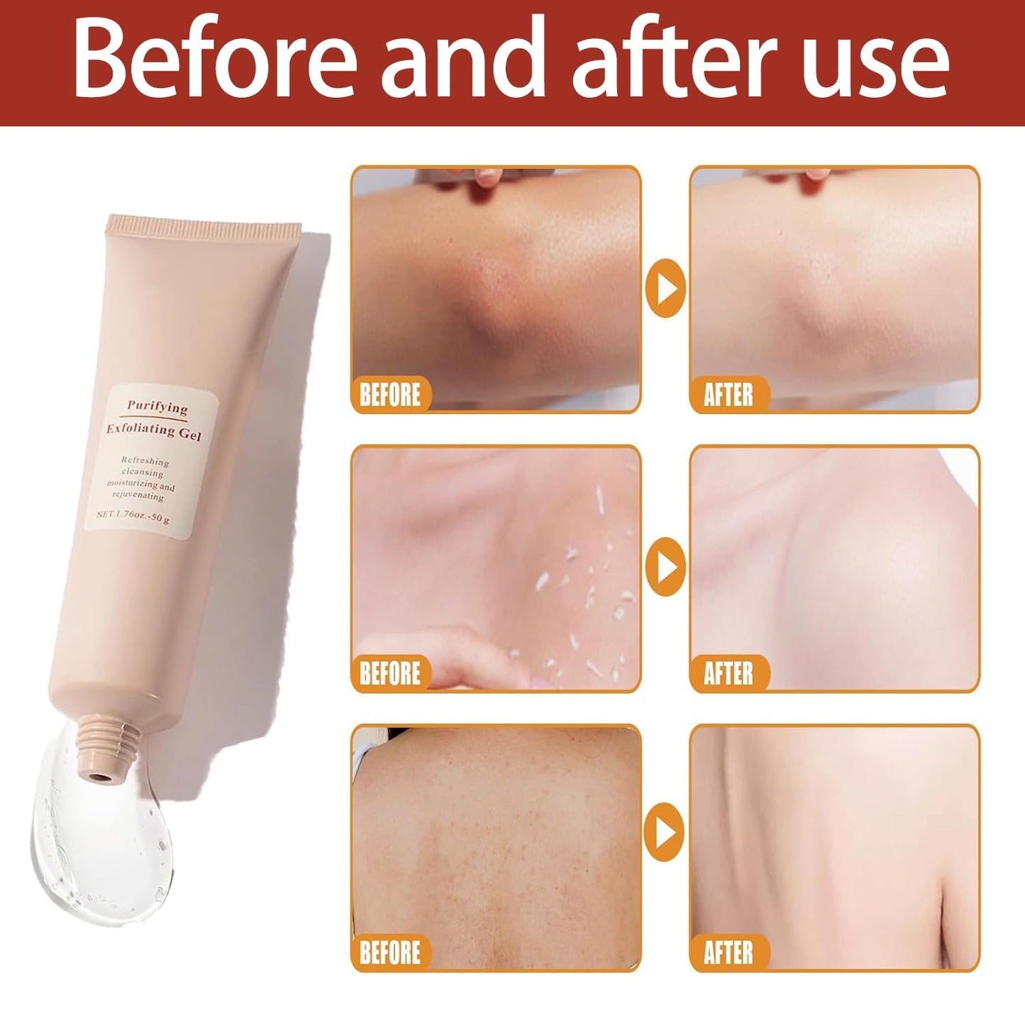 Exfoliating Gel with Sodium Hyaluronate and Vitamin C, Cherry Blossom Extract