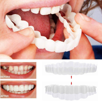 Clip On Veneers for Upper and Lower Teeth with Moldable Silicone Strip