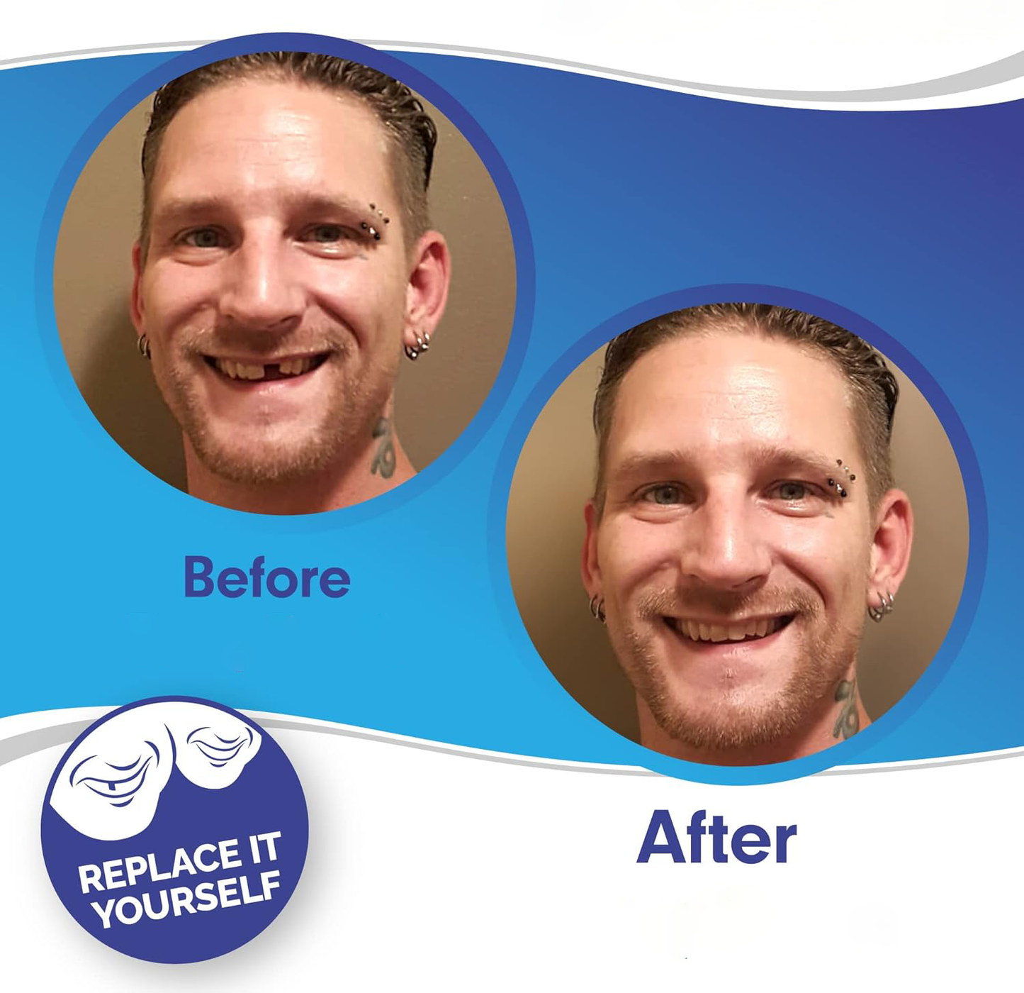 Clip On Veneers for Upper and Lower Teeth with Moldable Silicone Strip