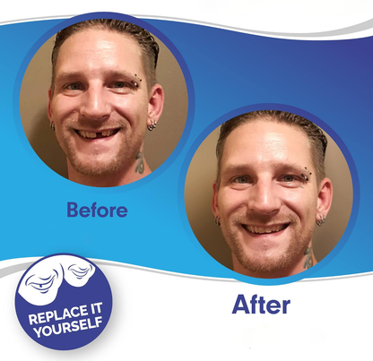 Clip On Veneers for Upper and Lower Teeth with Moldable Silicone Strip