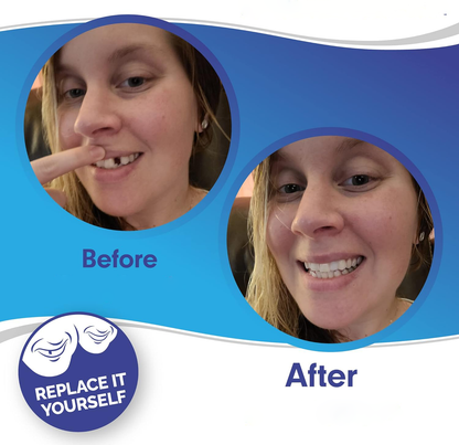 Clip On Veneers for Upper and Lower Teeth with Moldable Silicone Strip