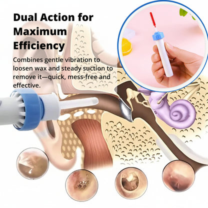 Electric Ear Wax Suction Tool with Silicone Tip and Ergonomic Handle, 60-Minute Battery