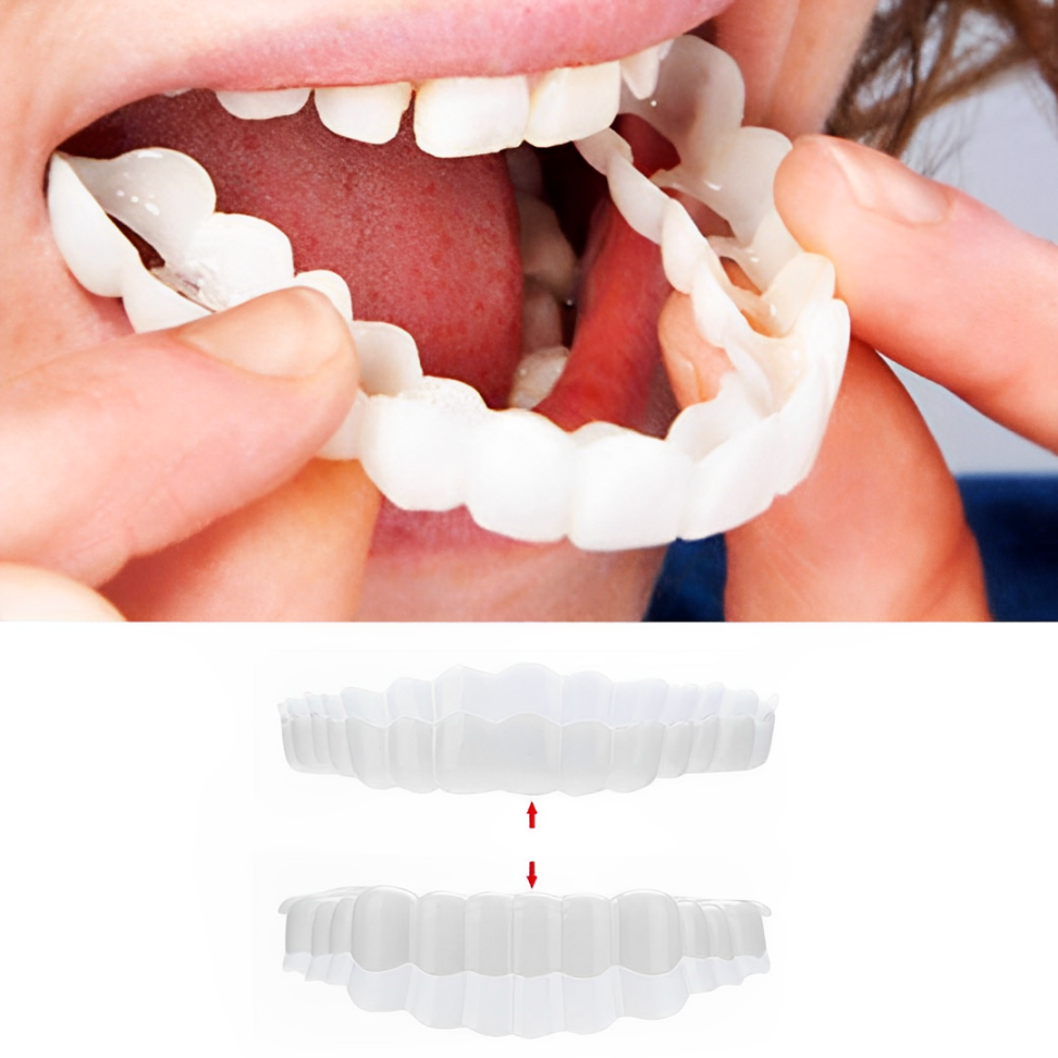 Clip On Veneers for Upper and Lower Teeth with Moldable Silicone Strip