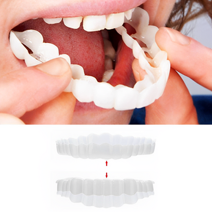 Clip On Veneers for Upper and Lower Teeth with Moldable Silicone Strip