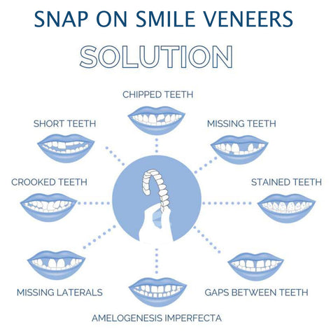 Clip On Veneers for Upper and Lower Teeth with Moldable Silicone Strip