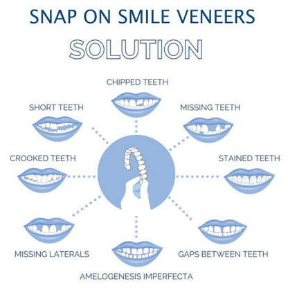 Clip On Veneers for Upper and Lower Teeth with Moldable Silicone Strip